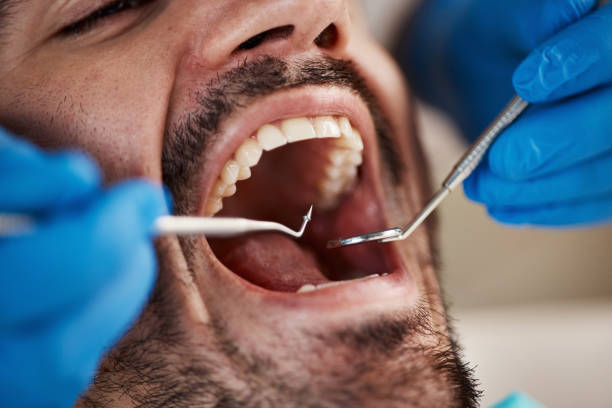 Best Pediatric Emergency Dentist in East Richmond Heights, CA