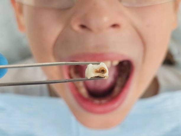 Best Weekend Emergency Dentist in East Richmond Heights, CA